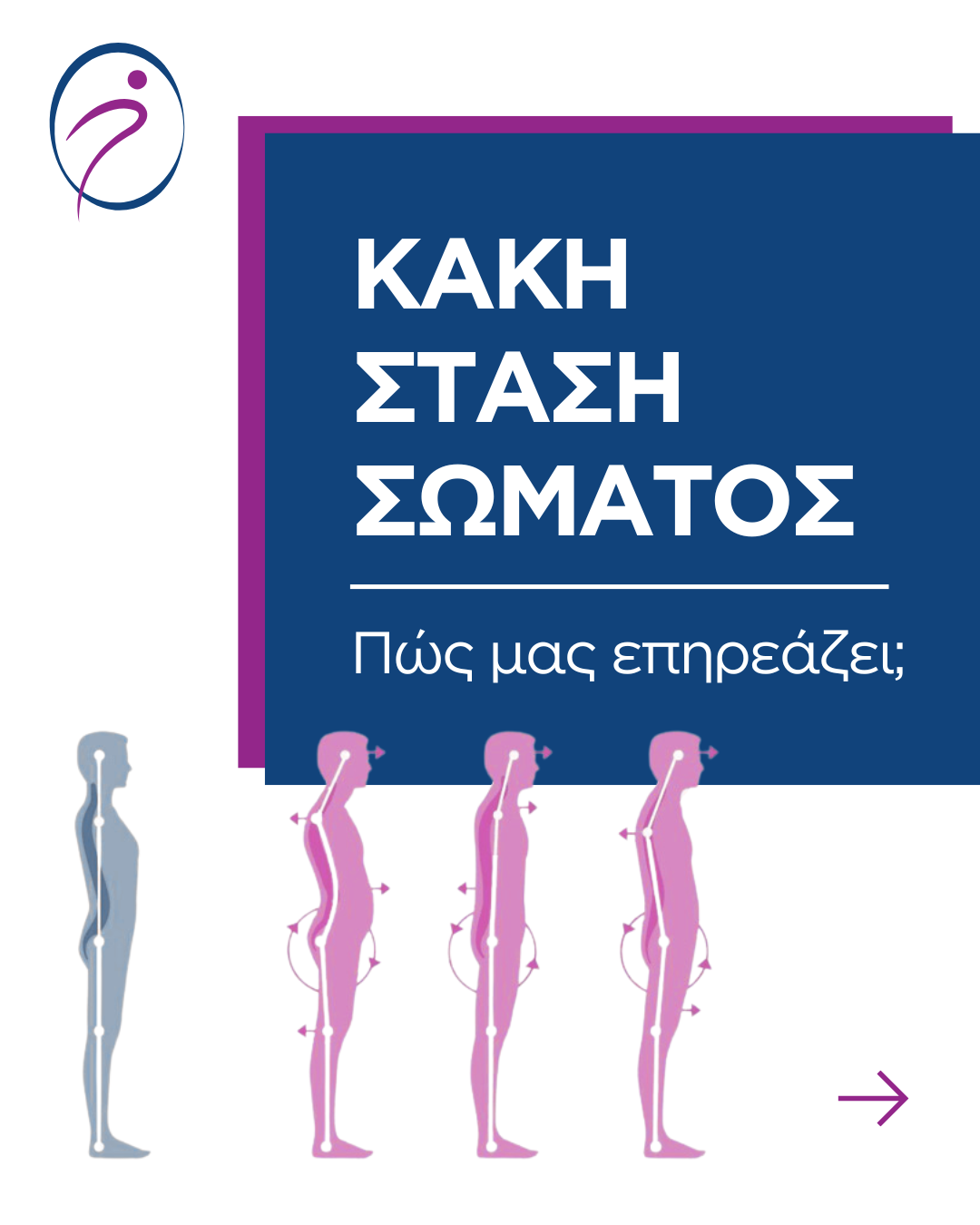Πως μας επηρεάζει η κακή στάση σώματος;
